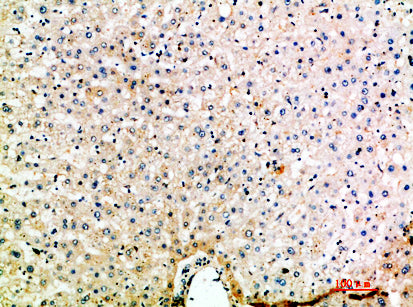 Macrophage Inflammatory Protein 5 Rabbit Polyclonal Antibody