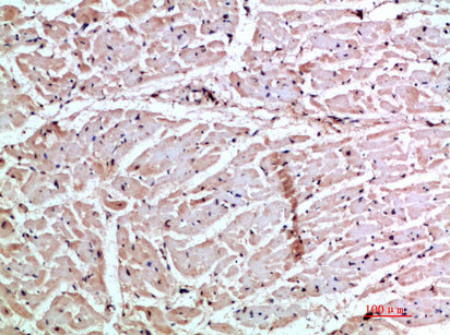 GRO gamma Rabbit Polyclonal Antibody