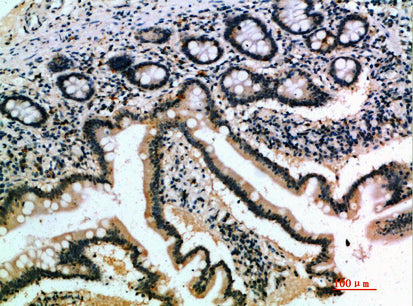 IL-17B Rabbit Polyclonal Antibody