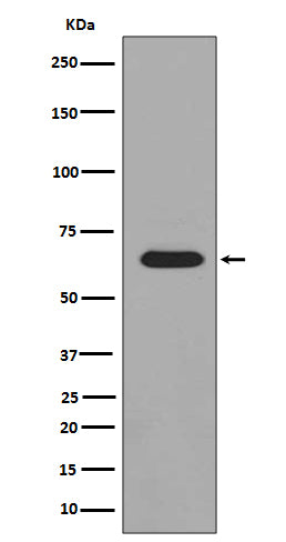 Phospho-PAK1/2/3 (Ser144/Ser141/Ser154) Rabbit Polyclonal Antibody