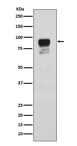 Phospho-Glycogen Synthase (Ser641) Rabbit Polyclonal Antibody