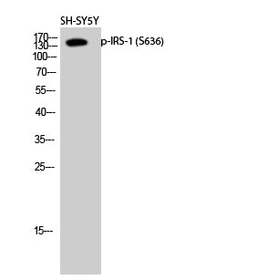 Phospho-IRS1 (Ser636) Rabbit Polyclonal Antibody