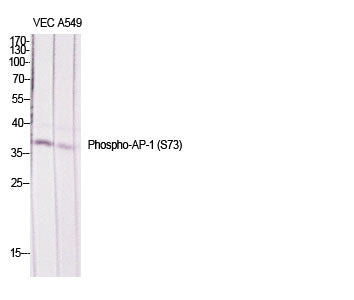 Phospho-JunD (Ser73/100) Rabbit Polyclonal Antibody