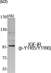 Phospho-IGF1 Receptor (Tyr1165/Tyr1166) Rabbit Polyclonal Antibody