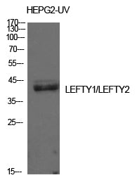 LEFTY Rabbit Polyclonal Antibody