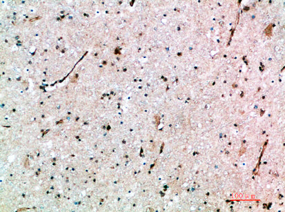 AVPR1B Rabbit Polyclonal Antibody