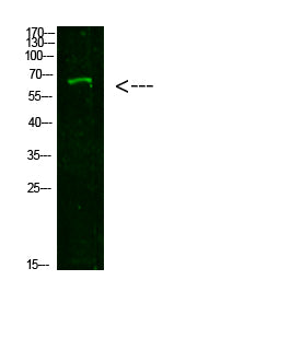 NUT Rabbit Polyclonal Antibody
