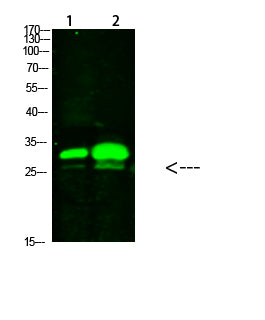 KCTD7 Rabbit Polyclonal Antibody