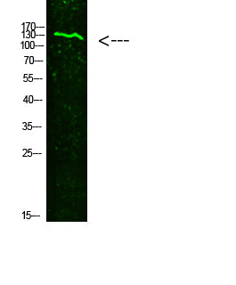 Collagen XIX alpha 1 Rabbit Polyclonal Antibody