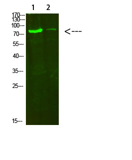 Collagen VIII alpha 2 Rabbit Polyclonal Antibody