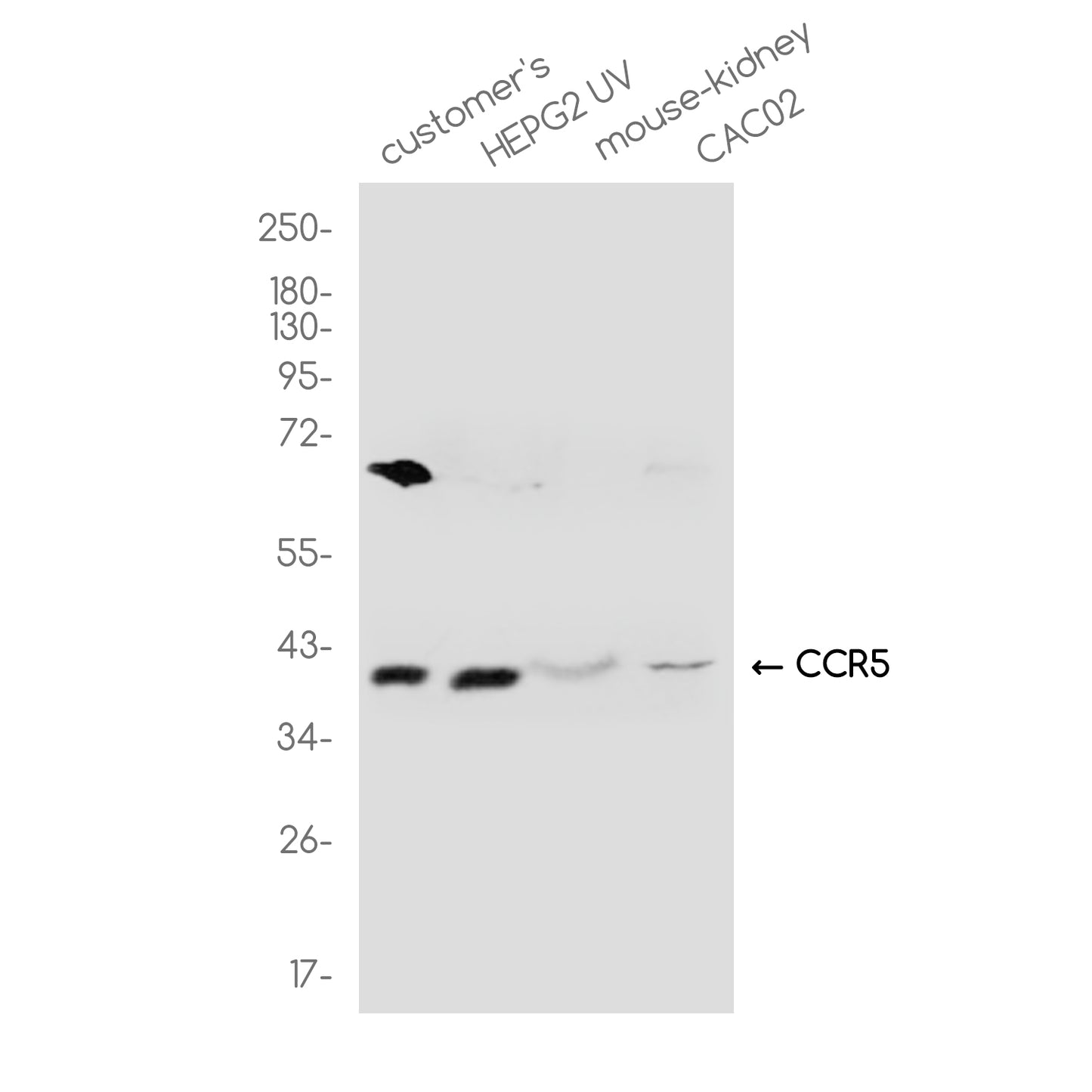 CCR5 Rabbit Polyclonal Antibody