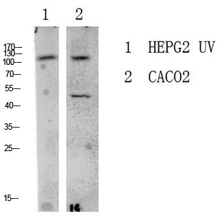 LATS1 Rabbit Polyclonal Antibody