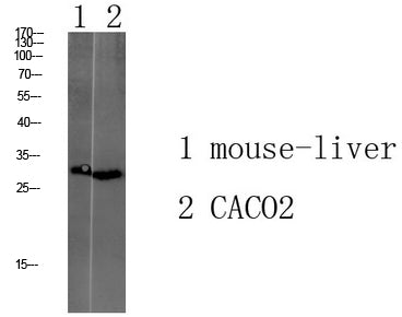 Transmembrane Protein 72 Rabbit Polyclonal Antibody