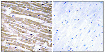 B3GALT2 Rabbit Polyclonal Antibody