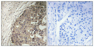 beta 4 GalNAcT1 Rabbit Polyclonal Antibody