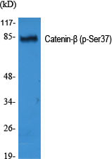 Phospho-beta Catenin (Ser37) Rabbit Polyclonal Antibody