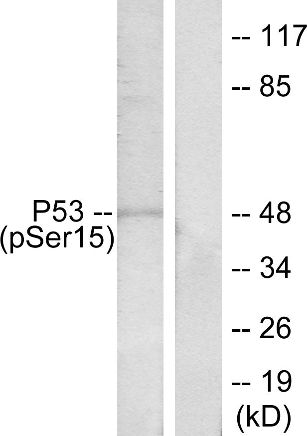 Phospho-p53 (Ser15) Rabbit Polyclonal Antibody