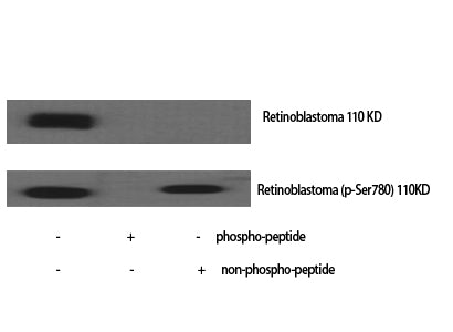Phospho-Rb (Ser780) Rabbit Polyclonal Antibody