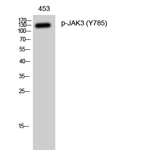 Phospho-JAK3 (Tyr785) Rabbit Polyclonal Antibody