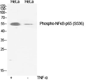Phospho-NF-KB p65 (Ser536) Rabbit Polyclonal Antibody