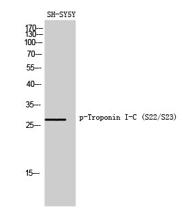 Phospho-Cardiac Troponin I (Ser22/Ser23) Rabbit Polyclonal Antibody
