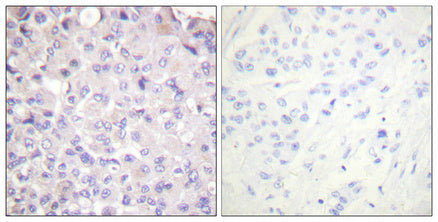 Phospho-IKK beta (Tyr188) Rabbit Polyclonal Antibody