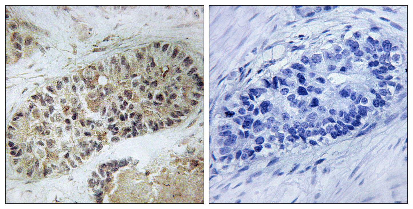 Phospho-Artemis (Ser516) Rabbit Polyclonal Antibody