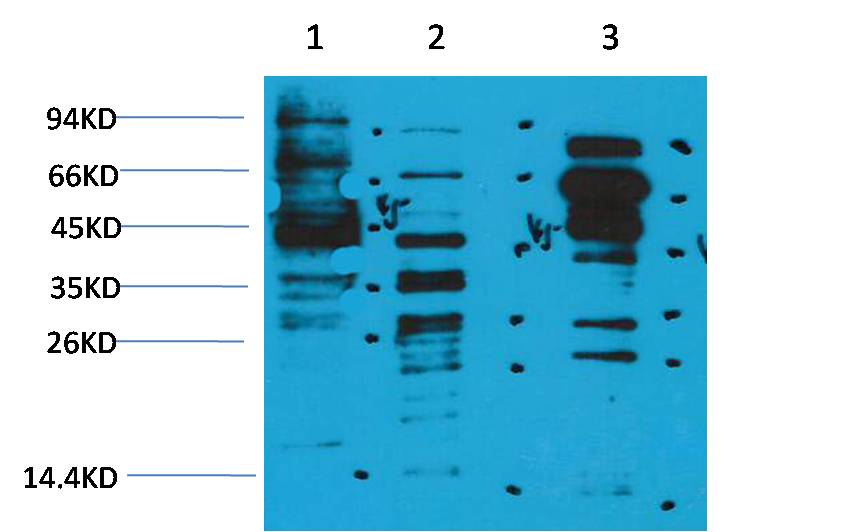 Acetyl-Lysine Rabbit Polyclonal Antibody