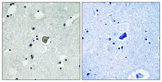 Phospho-NMDAR2A/2B (Tyr1246/Tyr1252) Rabbit Polyclonal Antibody