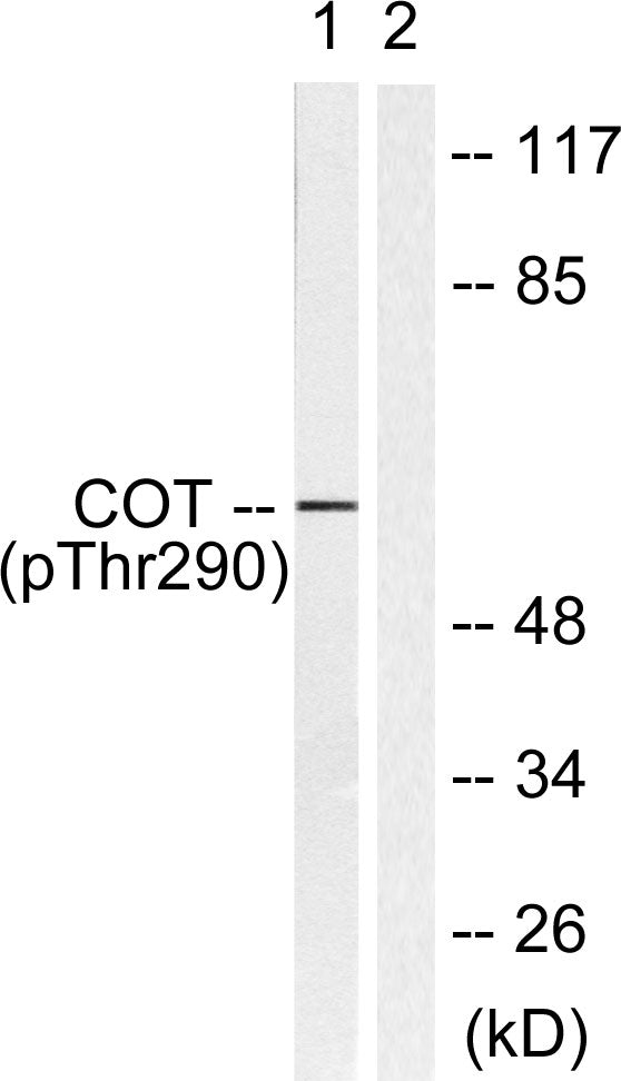 Phospho-COT (Thr290) Rabbit Polyclonal Antibody