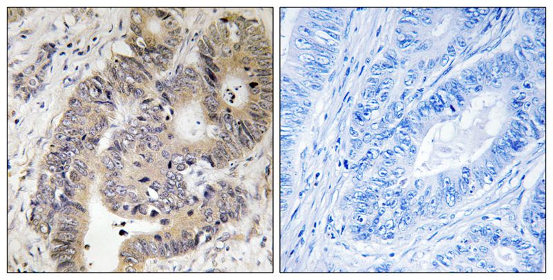 Phospho-CAD (Thr456) Rabbit Polyclonal Antibody