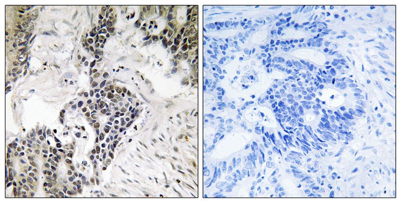 Phospho-CDC25C (Ser198) Rabbit Polyclonal Antibody