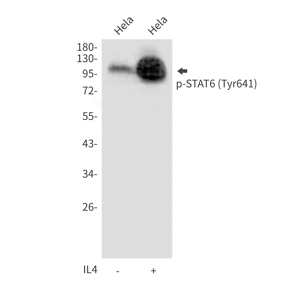 Phospho-STAT6 (Tyr641) Rabbit Polyclonal Antibody