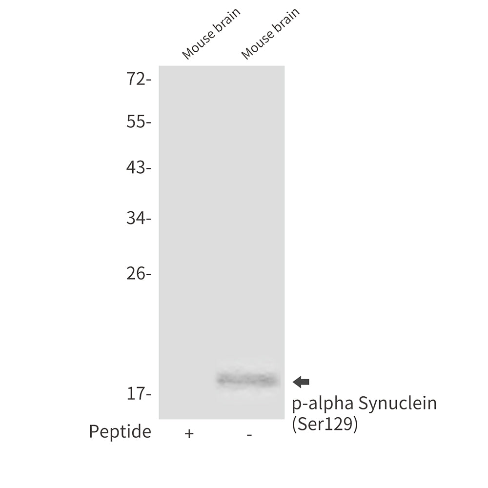 Phospho-alpha Synuclein (Ser129) Rabbit Polyclonal Antibody