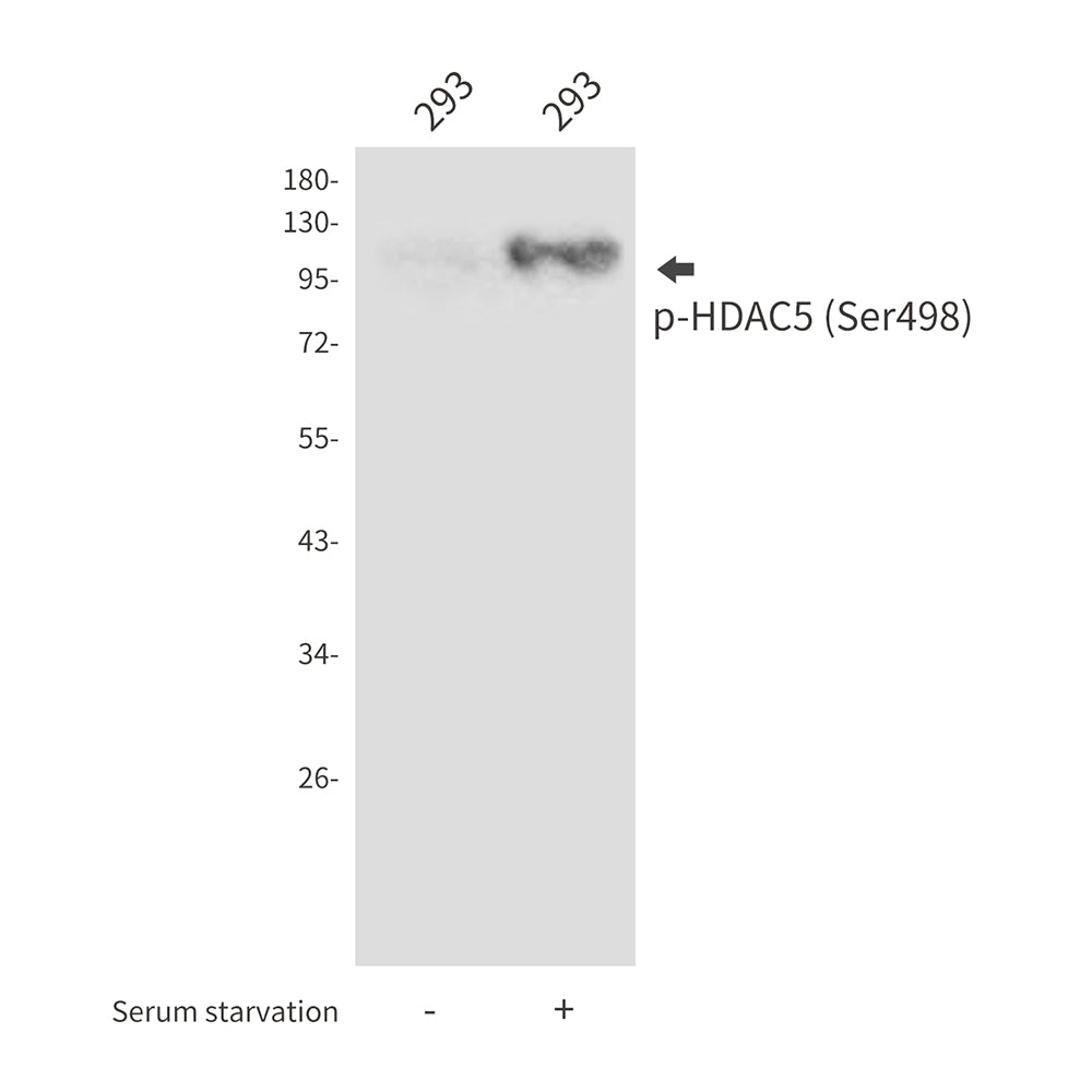 Phospho-HDAC5 (Ser498) Rabbit Polyclonal Antibody