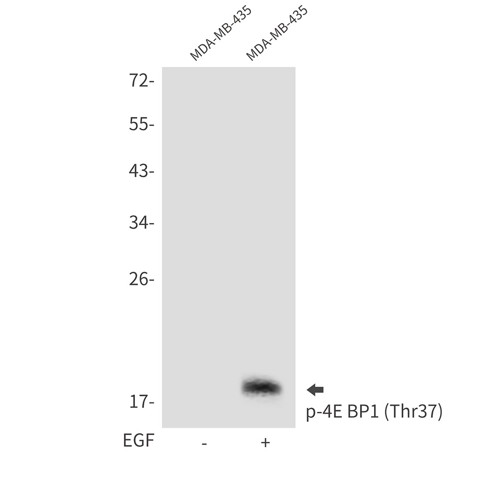 Phospho-4E BP1 (Thr37) Rabbit Polyclonal Antibody