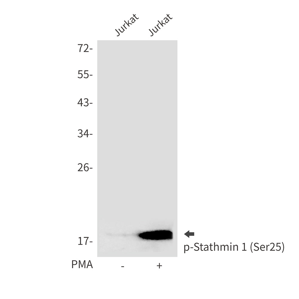 Phospho-Stathmin 1 (Ser25) Rabbit Polyclonal Antibody