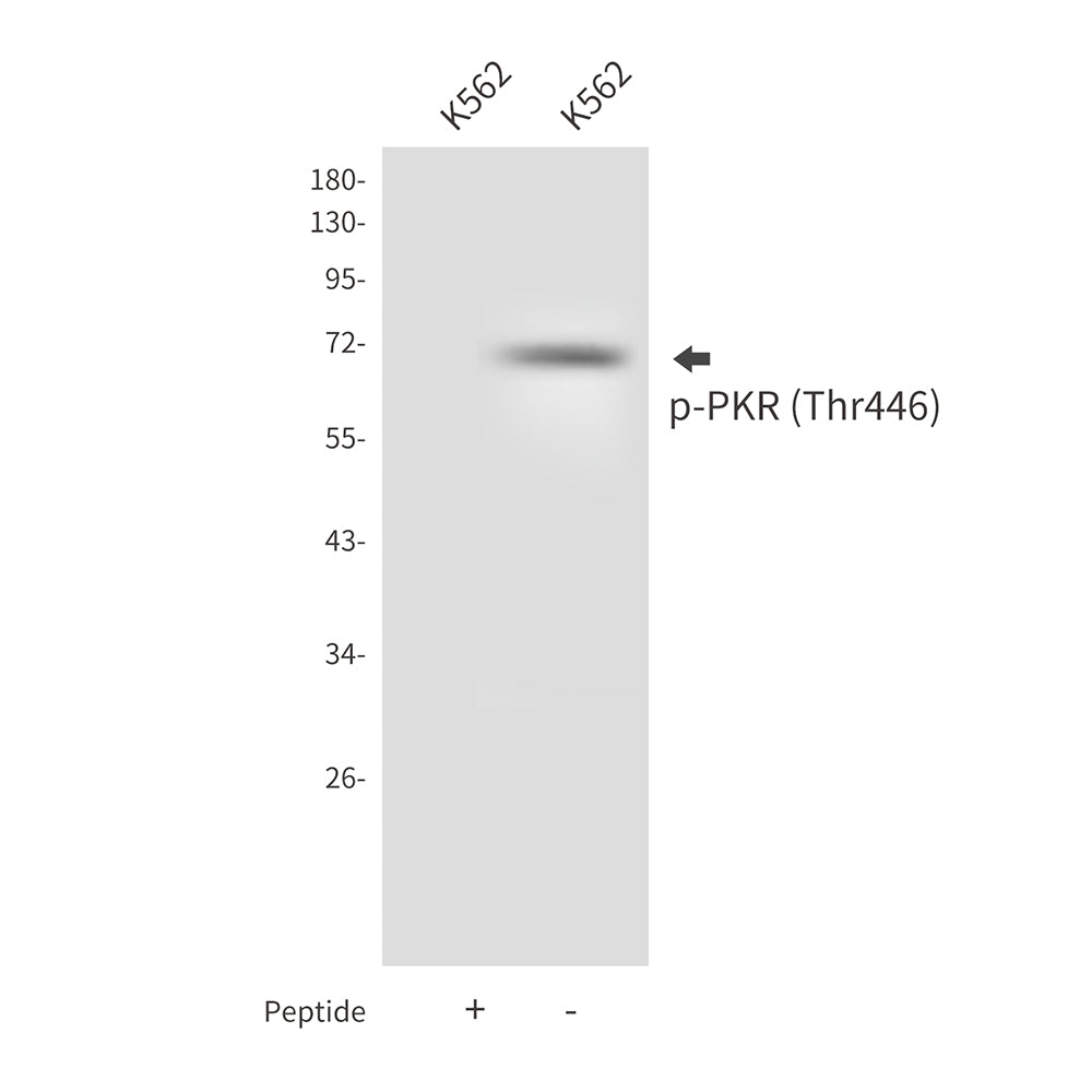 Phospho-PKR (Thr446) Rabbit Polyclonal Antibody