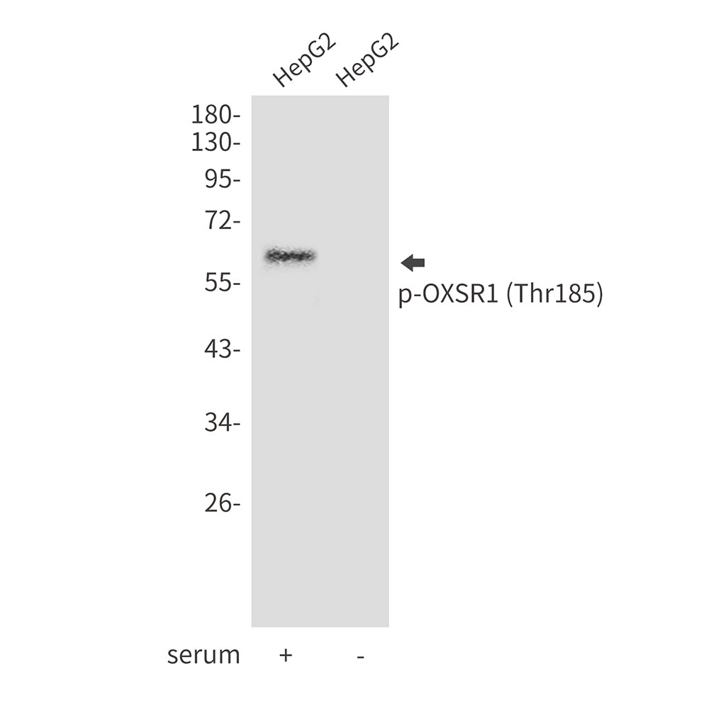 Phospho-OXSR1 (Thr185) Rabbit Polyclonal Antibody