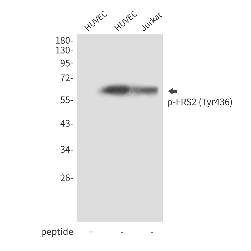 Phospho-FRS2 (Tyr436) Rabbit Polyclonal Antibody