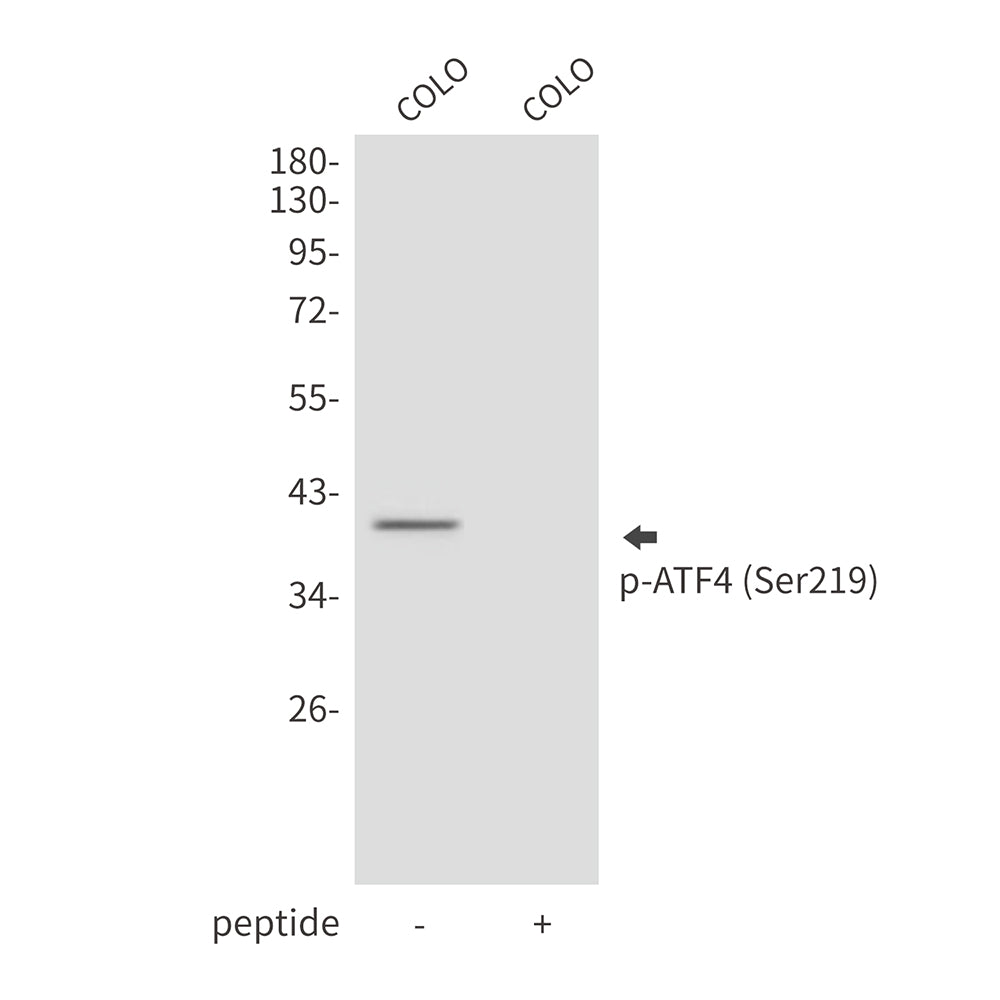 Phospho-ATF4 (Ser219) Rabbit Polyclonal Antibody