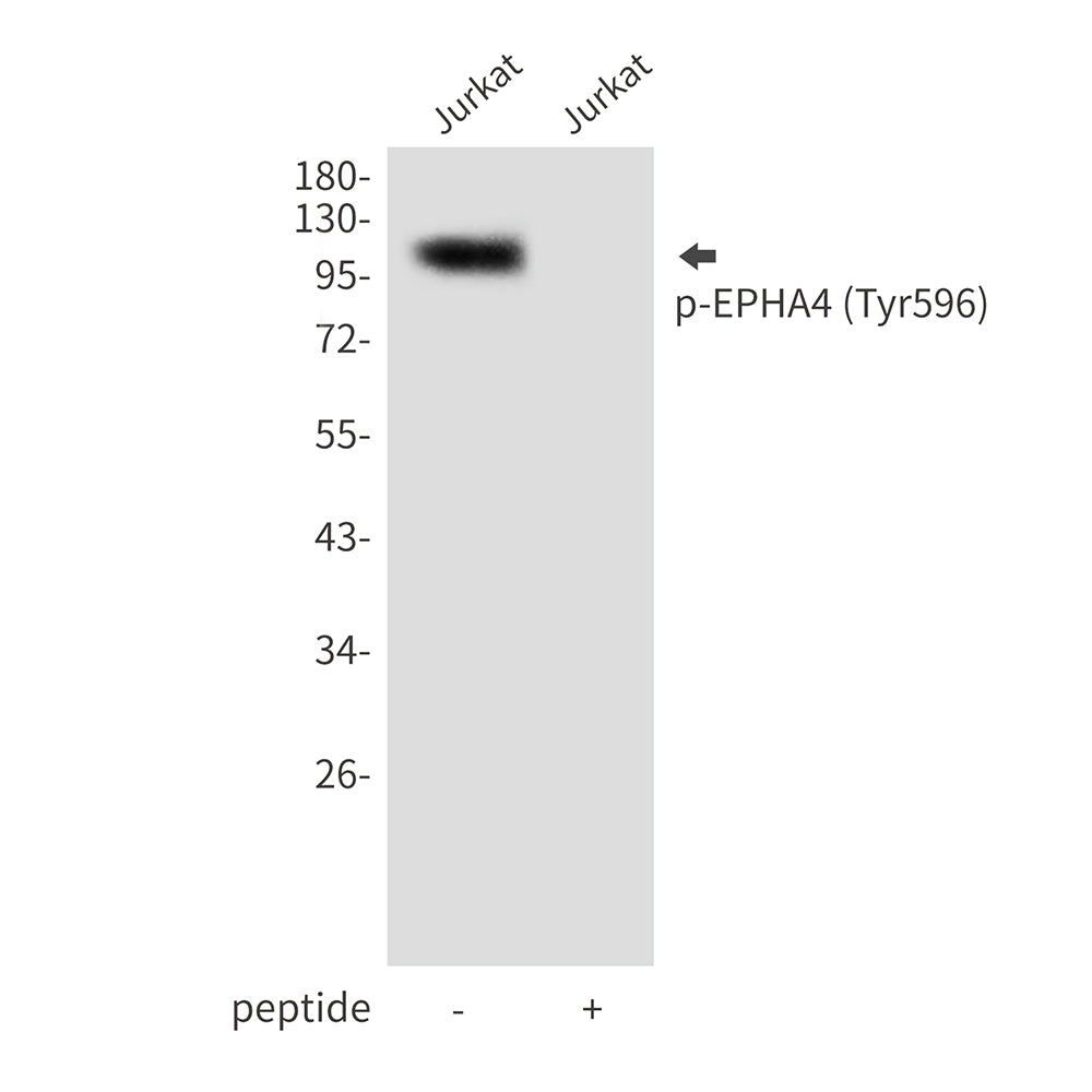 Phospho-EPHA4 (Tyr596) Rabbit Polyclonal Antibody
