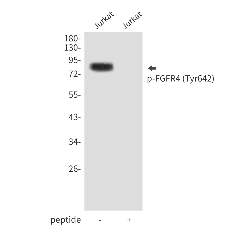 Phospho-FGFR4 (Tyr642) Rabbit Polyclonal Antibody