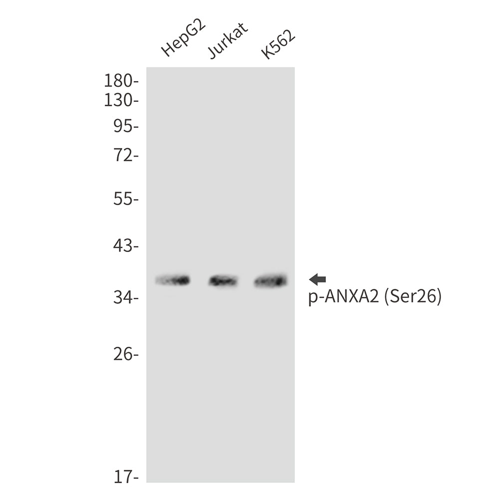Phospho-Annexin 2 (Ser26) Rabbit Polyclonal Antibody