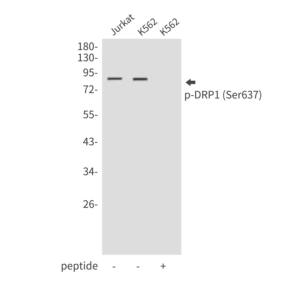 Phospho-DRP1 (Ser637) Rabbit Polyclonal Antibody