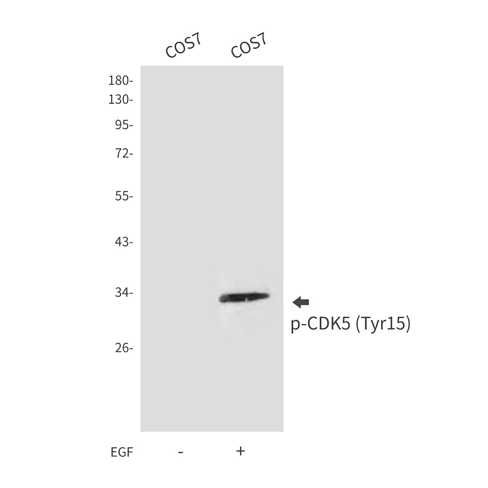 Phospho-CDK5 (Tyr15) Rabbit Polyclonal Antibody