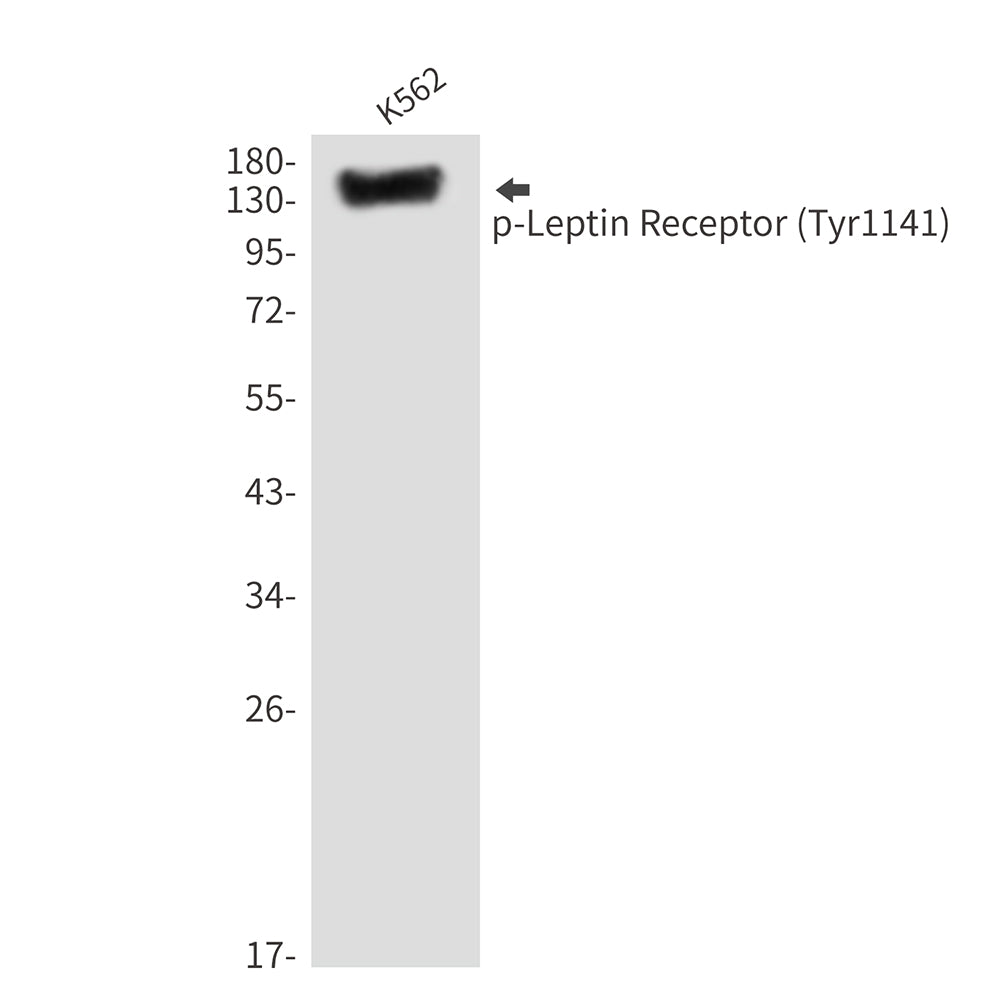 Phospho-Leptin Receptor (Tyr1141) Rabbit Polyclonal Antibody