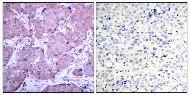 Phospho-PTEN (Ser380) Rabbit Polyclonal Antibody