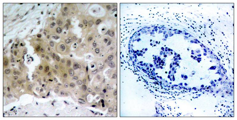 Phospho-VEGF Receptor 2 (Tyr1175) Rabbit Polyclonal Antibody