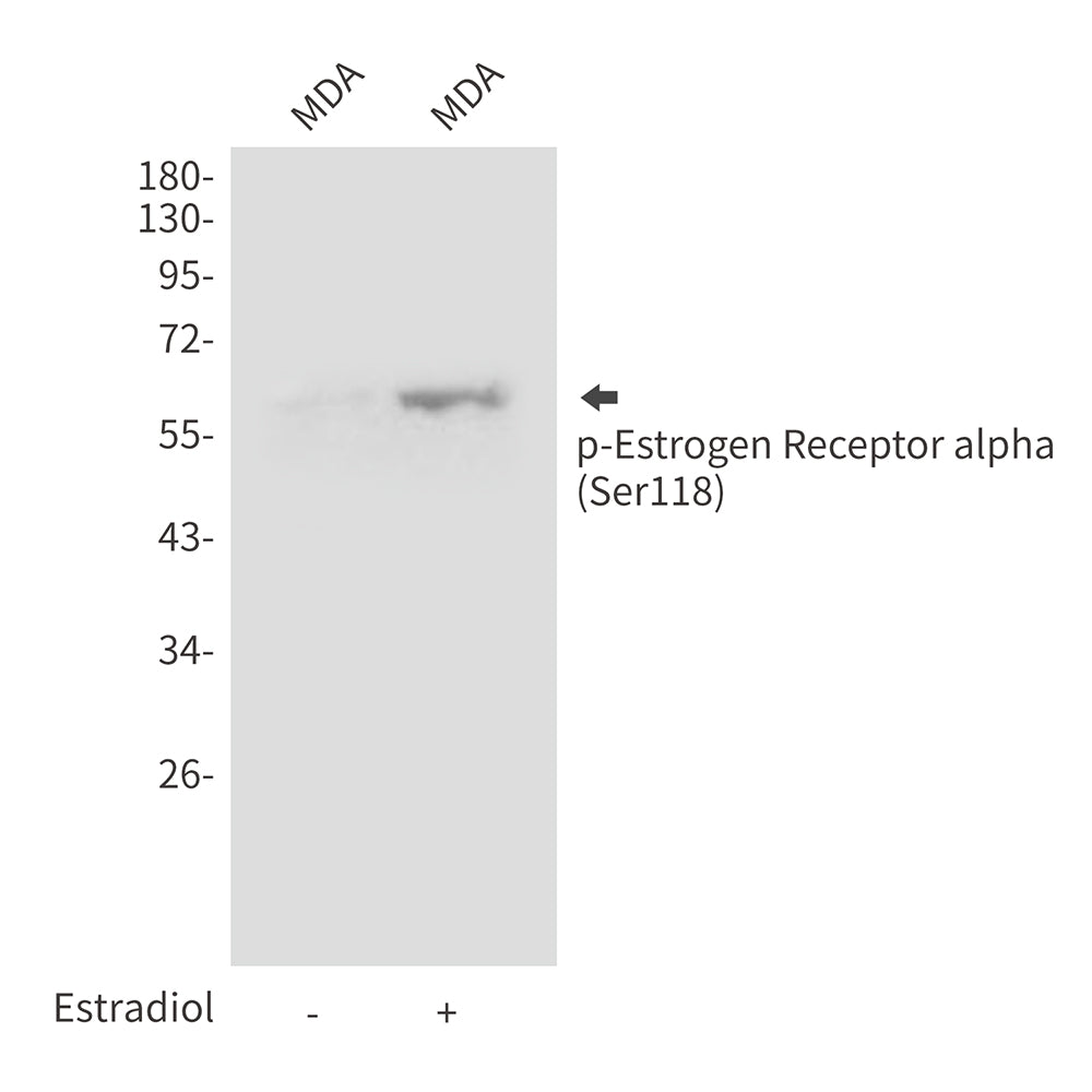 Phospho-Estrogen Receptor alpha (Ser118) Rabbit Polyclonal Antibody